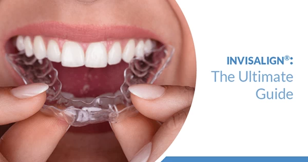 ما هو تقويم الأسنان الشفاف وكيف يعمل؟